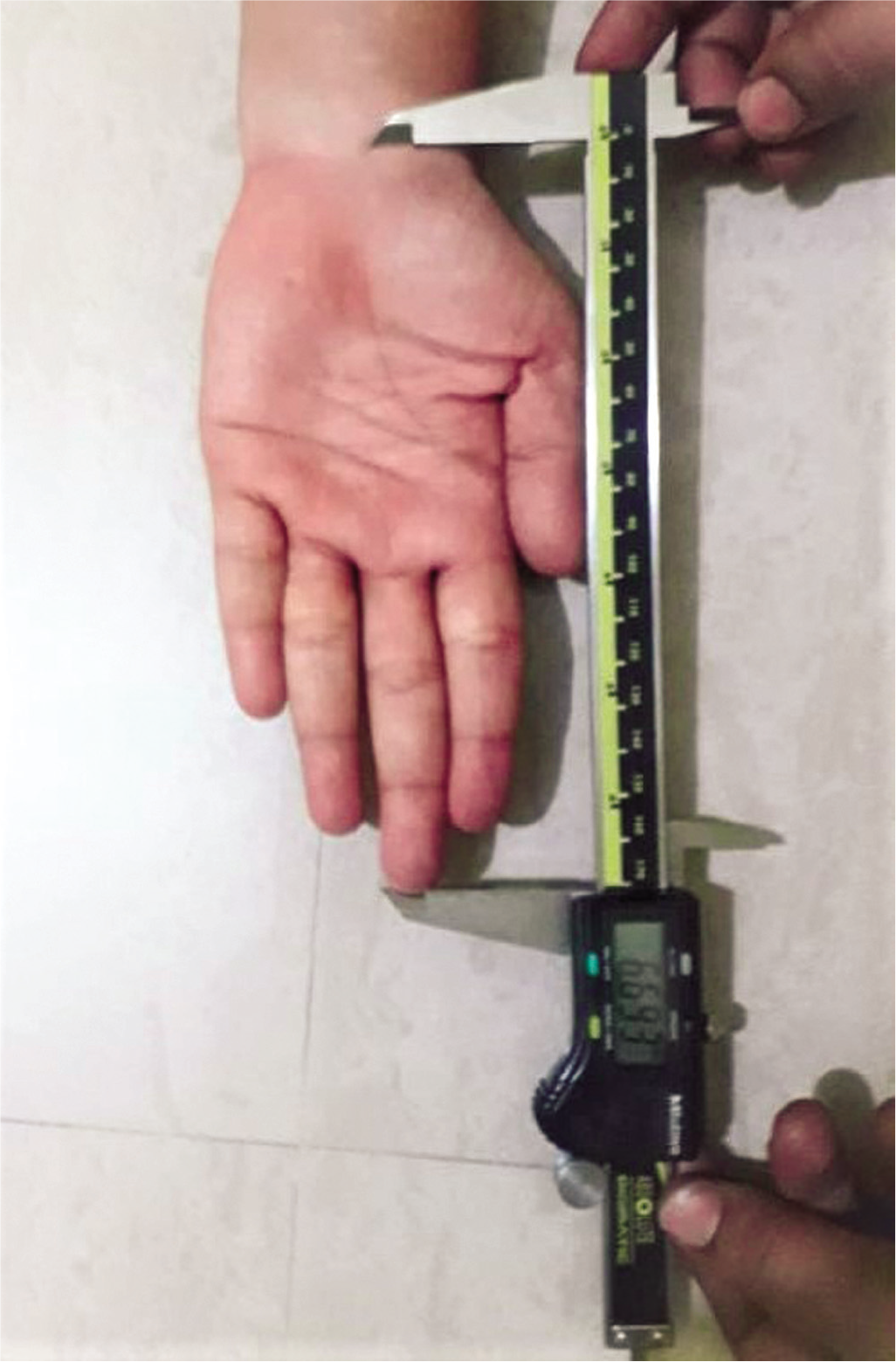 Hand length measurement