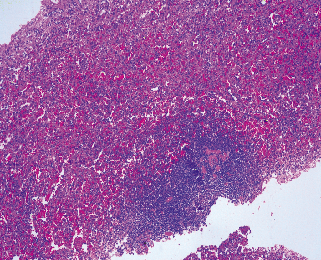 Haematoxylin and eosin histopathology slide showing typical splenic tissue