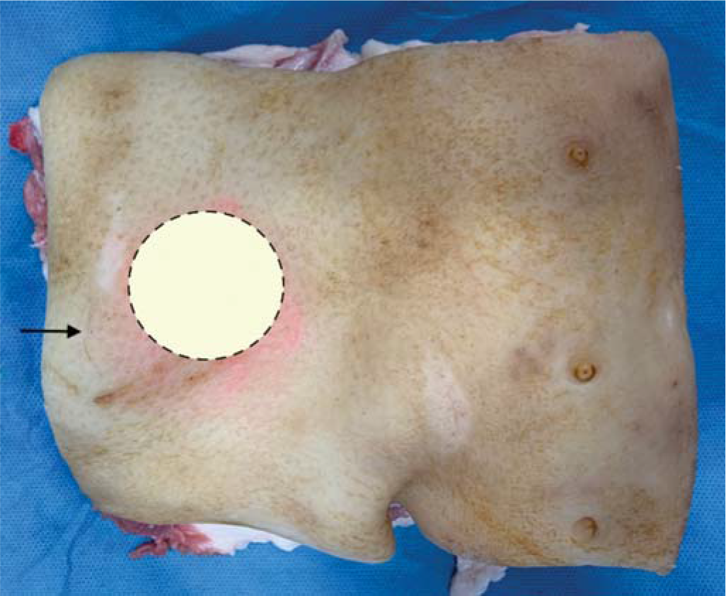 Simulated lump and abscess placed in subcutaneous plane of the pork belly (dotted circle); incision at the margin (arrow)