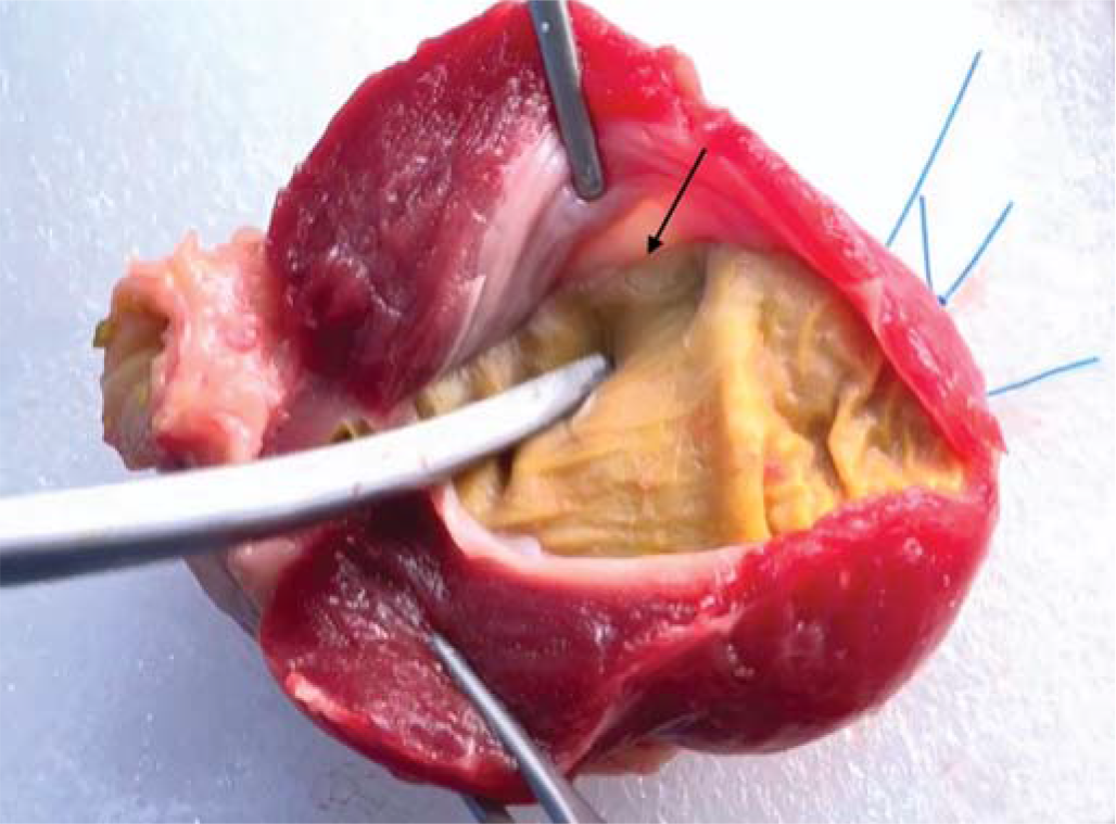 Plane of dissection between outer tough layer and mucosa of the chicken gizzard (arrow)