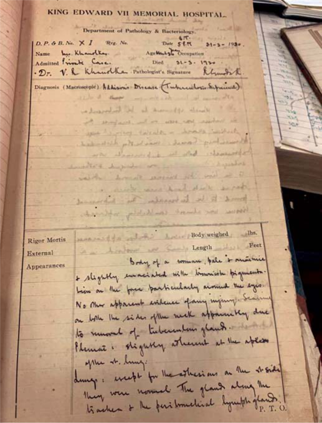 Autopsy on Mrs Khanolkar: Page from the autopsy register of KEM hospital