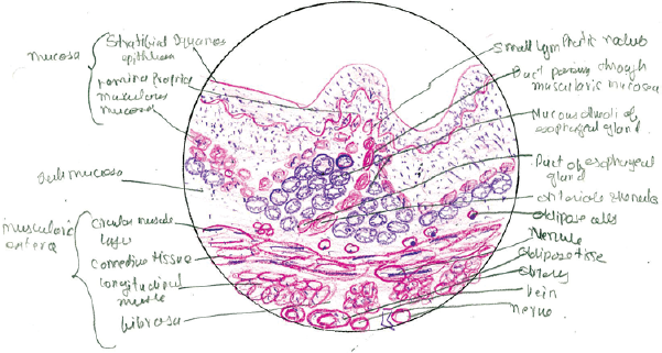 Diagram of student who scored low marks