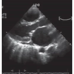 Article figure