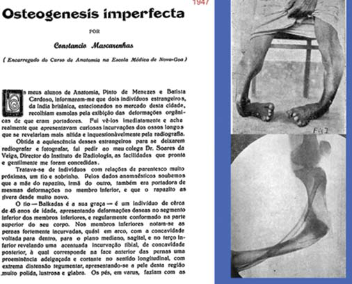 The paper entitled ‘Osteogenesis imperfacta’19 carried a clinical photograph and a radiograph